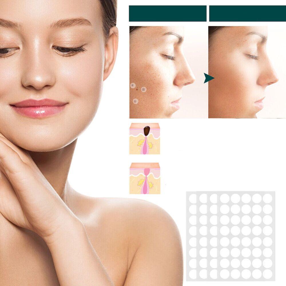 Hydrocolloid Blemish Removal Stickers for Sensitive Skin - Invisible Waterproof Patches for Neck, Hands & Body Care | Lonoma
