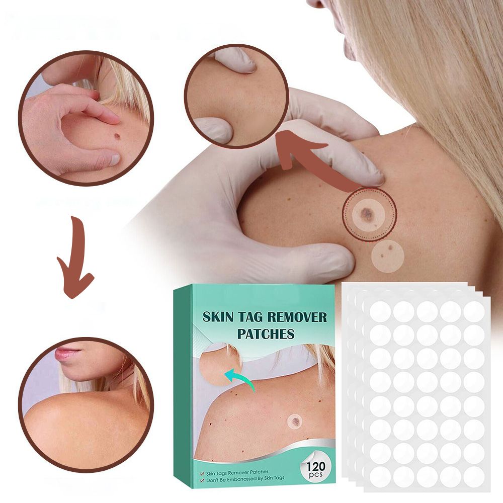 Hydrocolloid Blemish Removal Stickers for Sensitive Skin - Invisible Waterproof Patches for Neck, Hands & Body Care | Lonoma