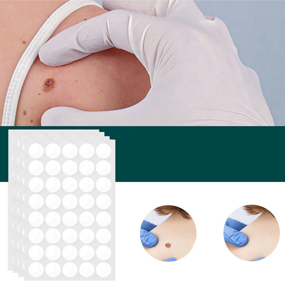 Hydrocolloid Blemish Removal Stickers for Sensitive Skin - Invisible Waterproof Patches for Neck, Hands & Body Care | Lonoma
