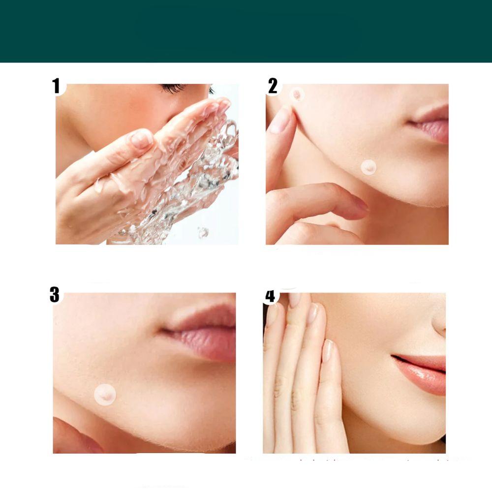 Hydrocolloid Blemish Removal Stickers for Sensitive Skin - Invisible Waterproof Patches for Neck, Hands & Body Care | Lonoma